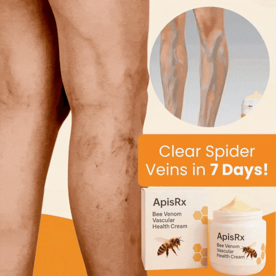 🔥Hot Sale🔥Anti-Varicose Cream | Visible Relief in Just 7 Days