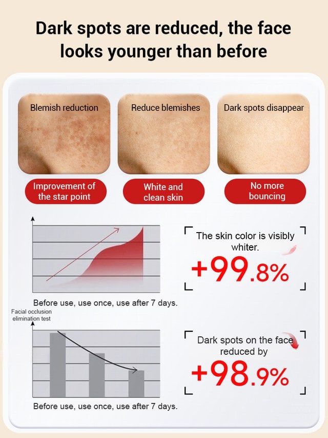 🔥Limited Time Discount🔥Upgraded anti-freckle essence oil