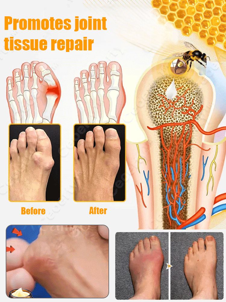 🔥Hot Sale 🔥 Bee Venom Joint Repair Cream