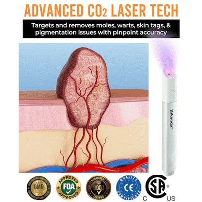 🔥Hot Sale🔥All-in-One CO₂ Laser Eraser Pen | Removes Moles, Warts, Skin Flaws & Pigmentation✨