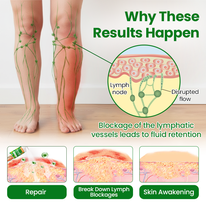 🔥Hot Sale 🔥LAOZIKTM VenoSoothe Leg Relief Spray