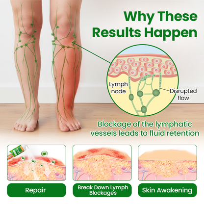 🔥Hot Sale 🔥LAOZIKTM VenoSoothe Leg Relief Spray