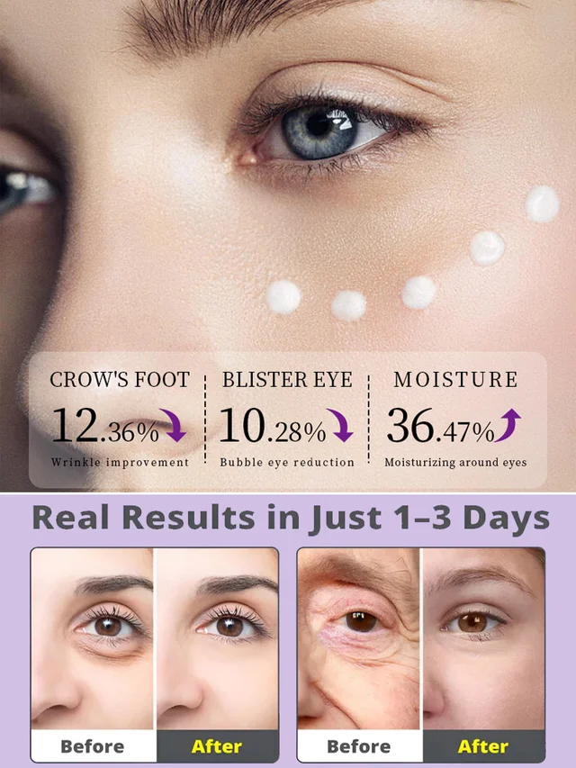 🔥Limited Time Discount 🔥[5 times anti-wrinkle] Firming Repair Eye Cream