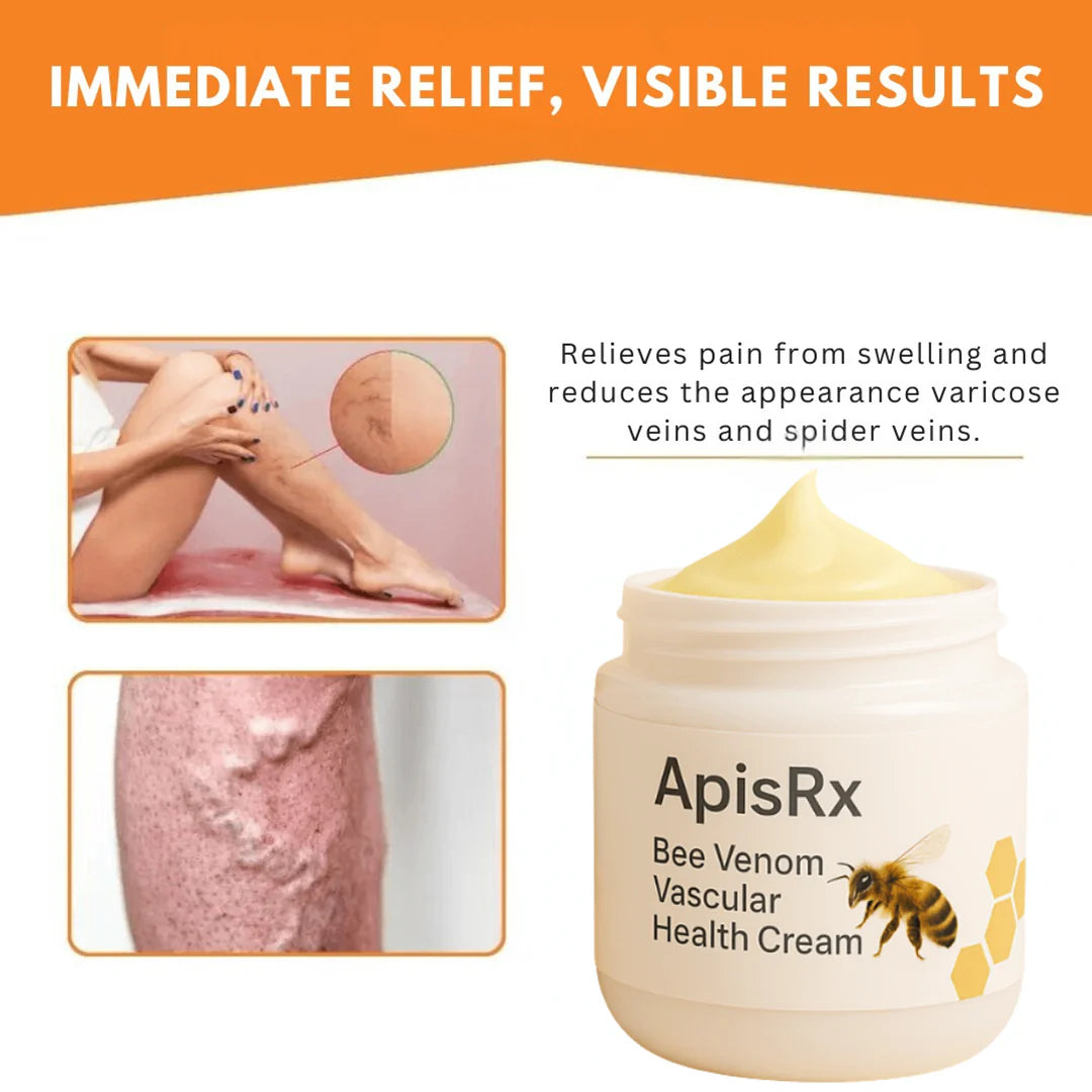 🔥Hot Sale🔥Anti-Varicose Cream | Visible Relief in Just 7 Days