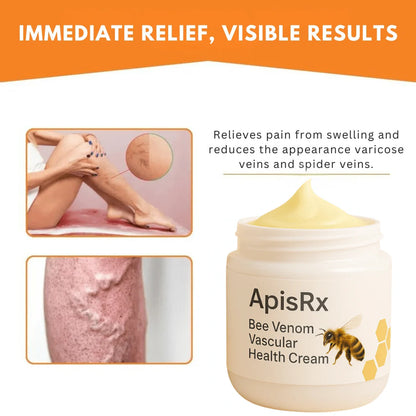 🔥Hot Sale🔥Anti-Varicose Cream | Visible Relief in Just 7 Days