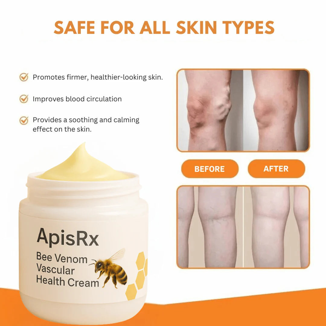 🔥Hot Sale🔥Anti-Varicose Cream | Visible Relief in Just 7 Days