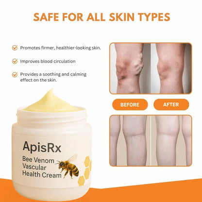 🔥Hot Sale🔥Anti-Varicose Cream | Visible Relief in Just 7 Days