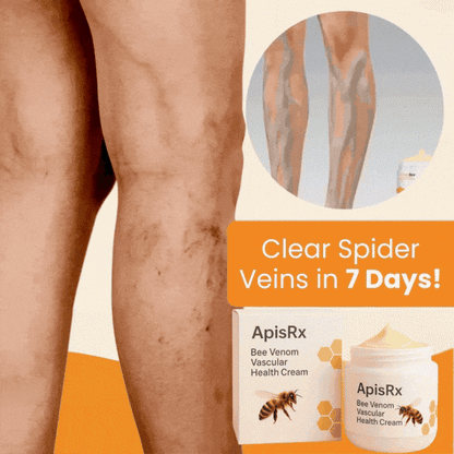 🔥Hot Sale🔥Anti-Varicose Cream | Visible Relief in Just 7 Days