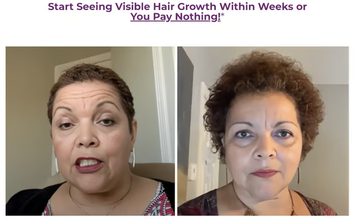 🔥Hot Sale 50% OFF🔥Allurium Hair Growth Serum™