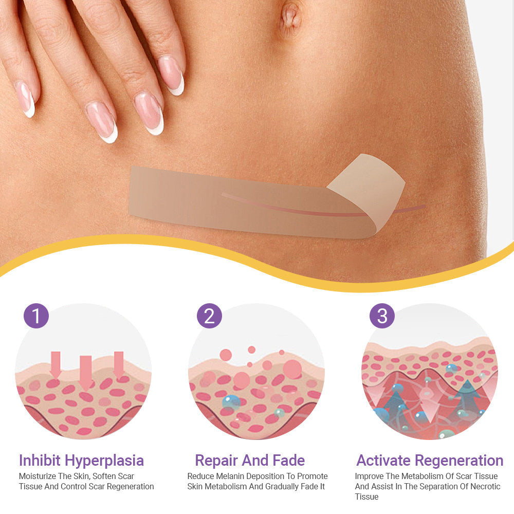 ✅Official Store |BBOJI® Hyaluronic Acid Nano Microneedle Repair Tape🏥(Treatment of old and new scars, reduction of surgical scars, stretch marks, keloids, acne, burns, warts, dermatomes and varicose veins)