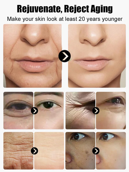 🔥Hot Sale 🔥【10 Years Younger】Tallow Facial Anti-Wrinkle Moisturizing and Skin Softening Serum