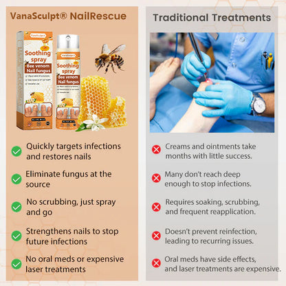 🔥Hot Sale🔥VanaSculpt® Bee Venom Nail Fungus Spray