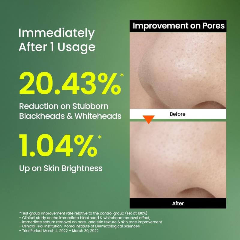 🔥Limited Time Discount🔥Skin Detox Trio Set with Mung Bean Complex