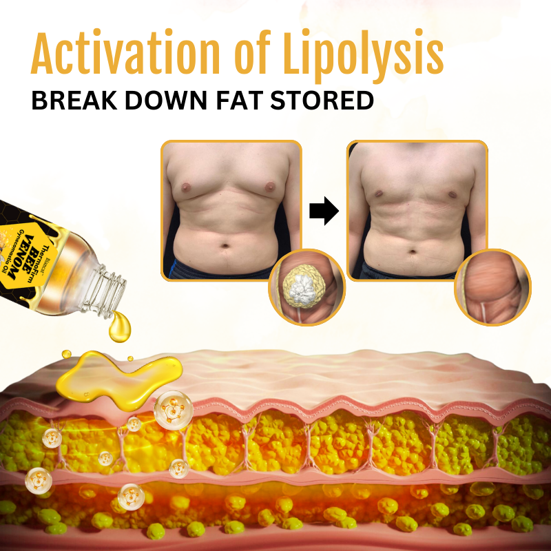 🔥Hot Sale 🔥ThermoFirm Bee Venom Gynecomastia Oil