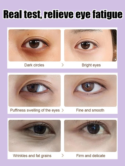 🔥Limited Time Discount 🔥[5 times anti-wrinkle] Firming Repair Eye Cream