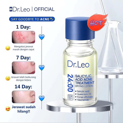 ⏰Last 4 hours Sale: Save 60%-🔥Salicylic Acid Acne Treatment Drying Lotion