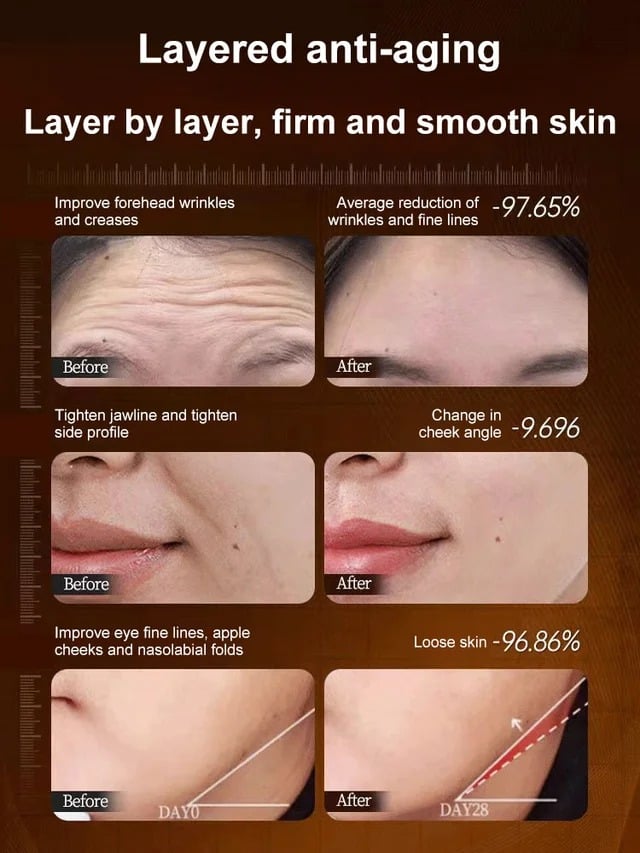 🔥Hot Sale 50% OFF🔥[One touch to remove wrinkles]Micro-molecular collagen anti-wrinkle lotion