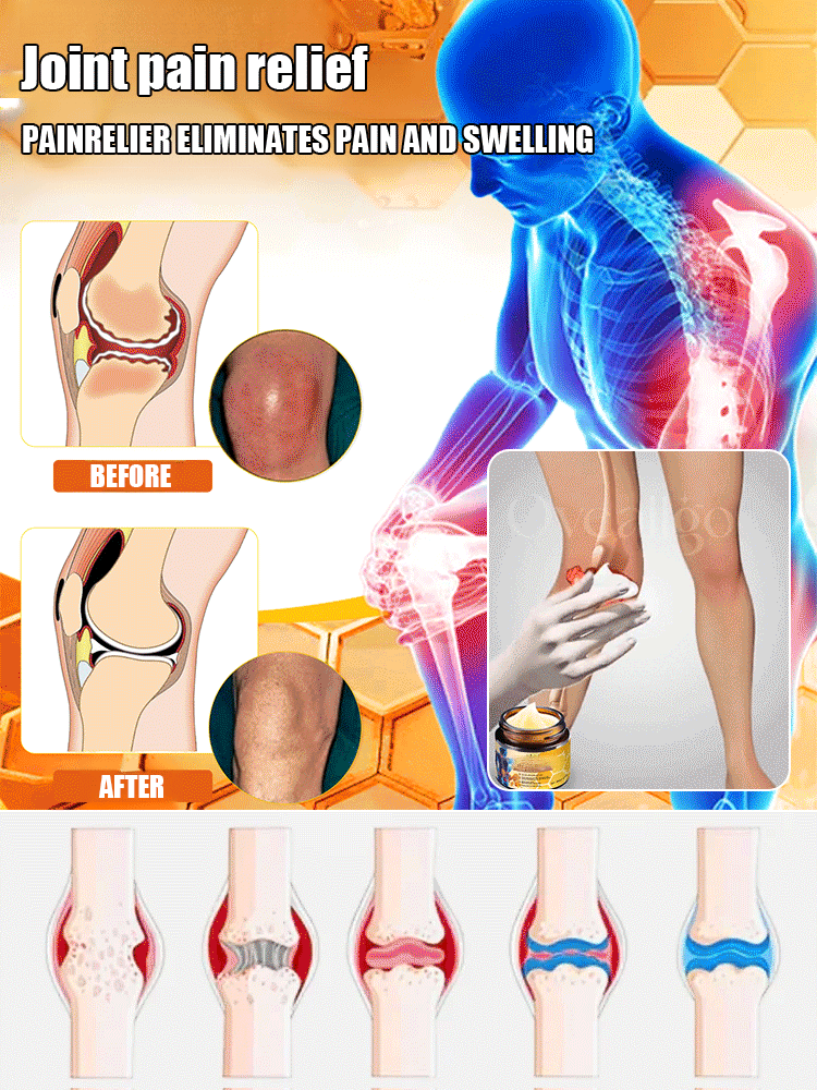 🔥Hot Sale 🔥 Bee Venom Joint Repair Cream