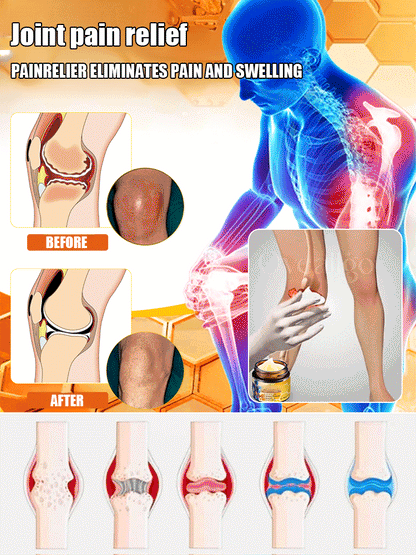 🔥Hot Sale 🔥 Bee Venom Joint Repair Cream