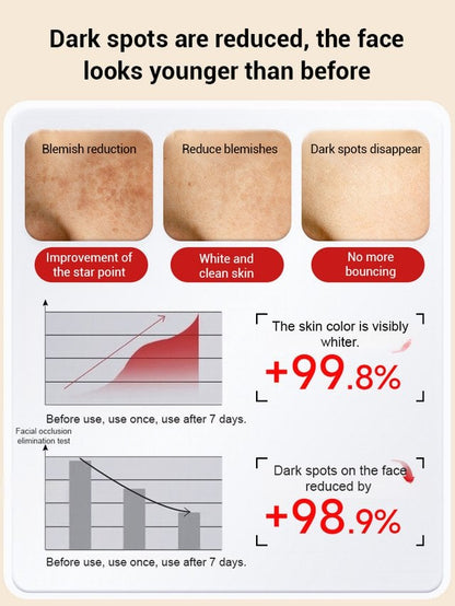 🔥Limited Time Discount🔥Upgraded anti-freckle essence oil