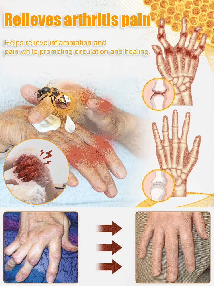 🔥Hot Sale 🔥 Bee Venom Joint Repair Cream