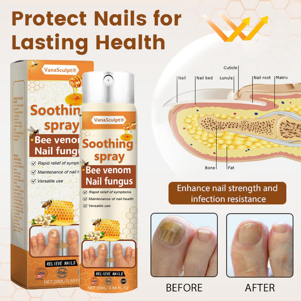 🔥Hot Sale🔥VanaSculpt® Bee Venom Nail Fungus Spray
