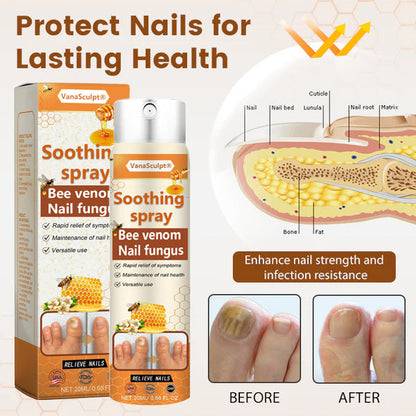 🔥Hot Sale🔥VanaSculpt® Bee Venom Nail Fungus Spray