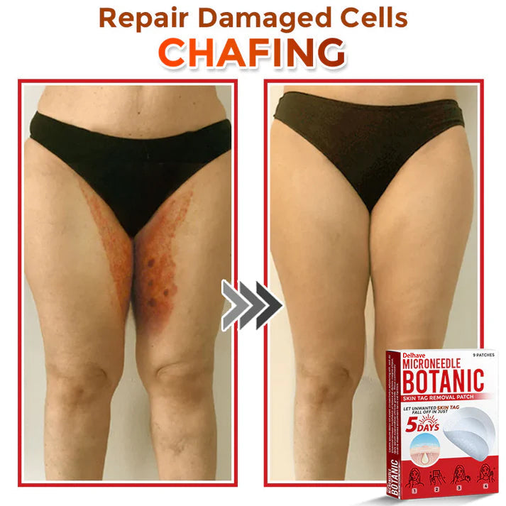 🔥Limited Time Discount🔥DELHAVE® MicroNeedle Botanic Skin Tag Removal Patch 🇺🇸 Made in the USA