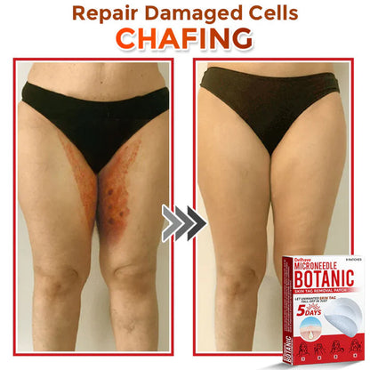 🔥Limited Time Discount🔥DELHAVE® MicroNeedle Botanic Skin Tag Removal Patch 🇺🇸 Made in the USA