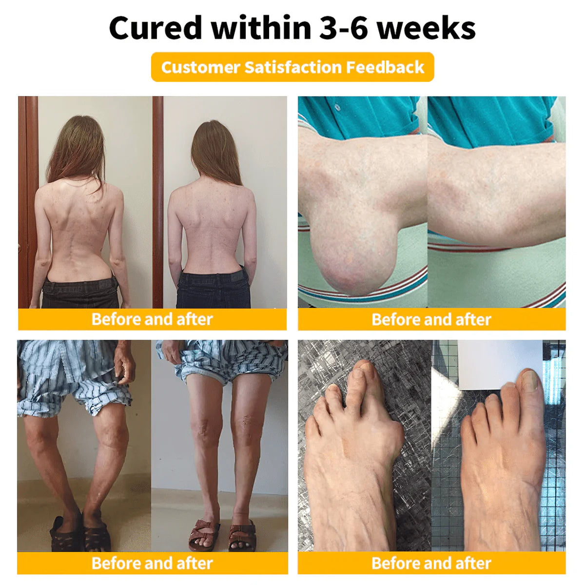 🔥Hot Sale🔥Zentheca BeeThera | Bee Venom-Infused Relief for Bones & Joints