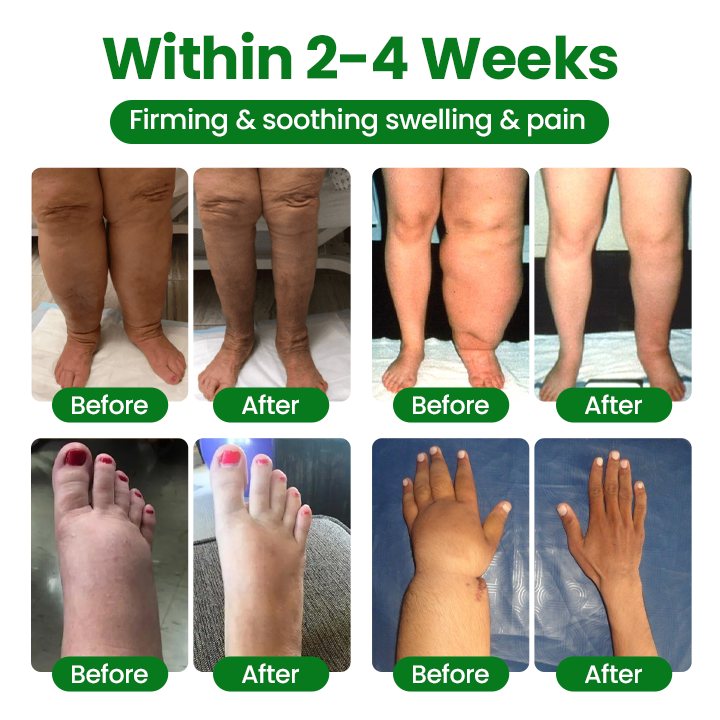 🔥Hot Sale 🔥LAOZIKTM VenoSoothe Leg Relief Spray