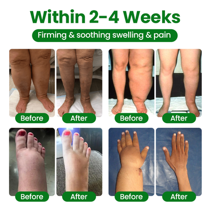 🔥Hot Sale 🔥LAOZIKTM VenoSoothe Leg Relief Spray