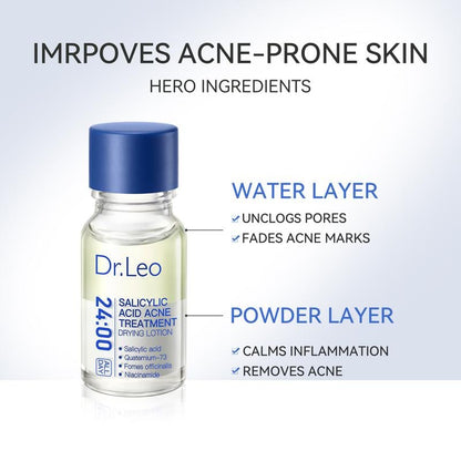 ⏰Last 4 hours Sale: Save 60%-🔥Salicylic Acid Acne Treatment Drying Lotion