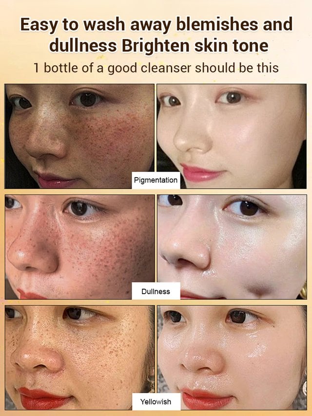 🔥Limited Time Discount🔥Upgraded anti-freckle essence oil