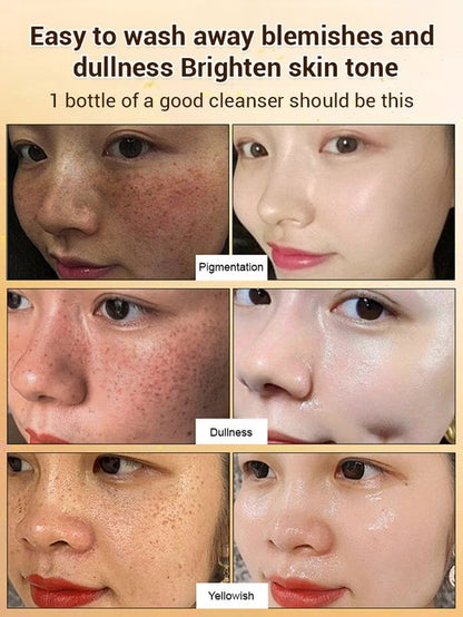 🔥Limited Time Discount🔥Upgraded anti-freckle essence oil