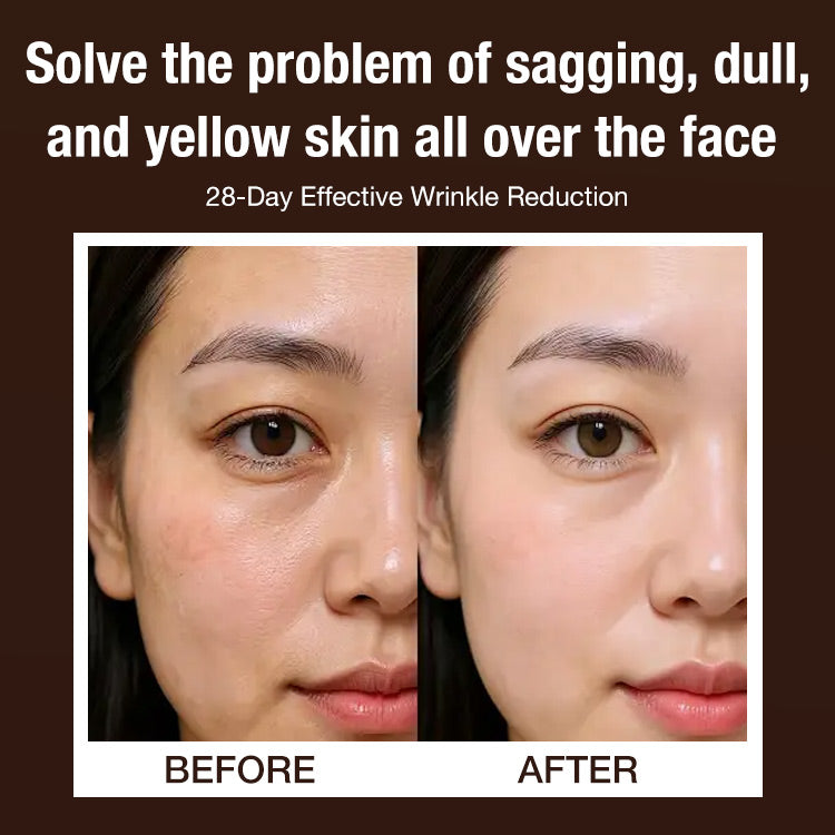 🔥Hot Sale 50% OFF🔥Lingzhi Anti-Wrinkle Revitalizing Essence - Reduces fine lines/Deep repair/Moisturizes and firms skin - Effectively reduces wrinkles in 28 days