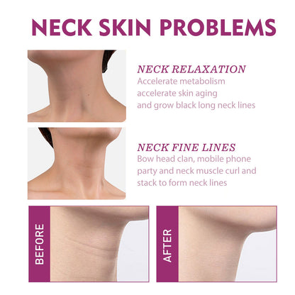 🔥Limited-time offer🔥Spain NECKPON Hydrolyzed Collagen Neck Cream