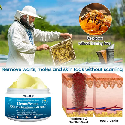 🔥Hot Sale🔥Timilk® DermaVenom RX+ Precision Removal Cream