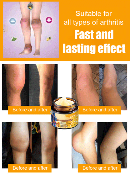 🔥Hot Sale 🔥 Bee Venom Joint Repair Cream