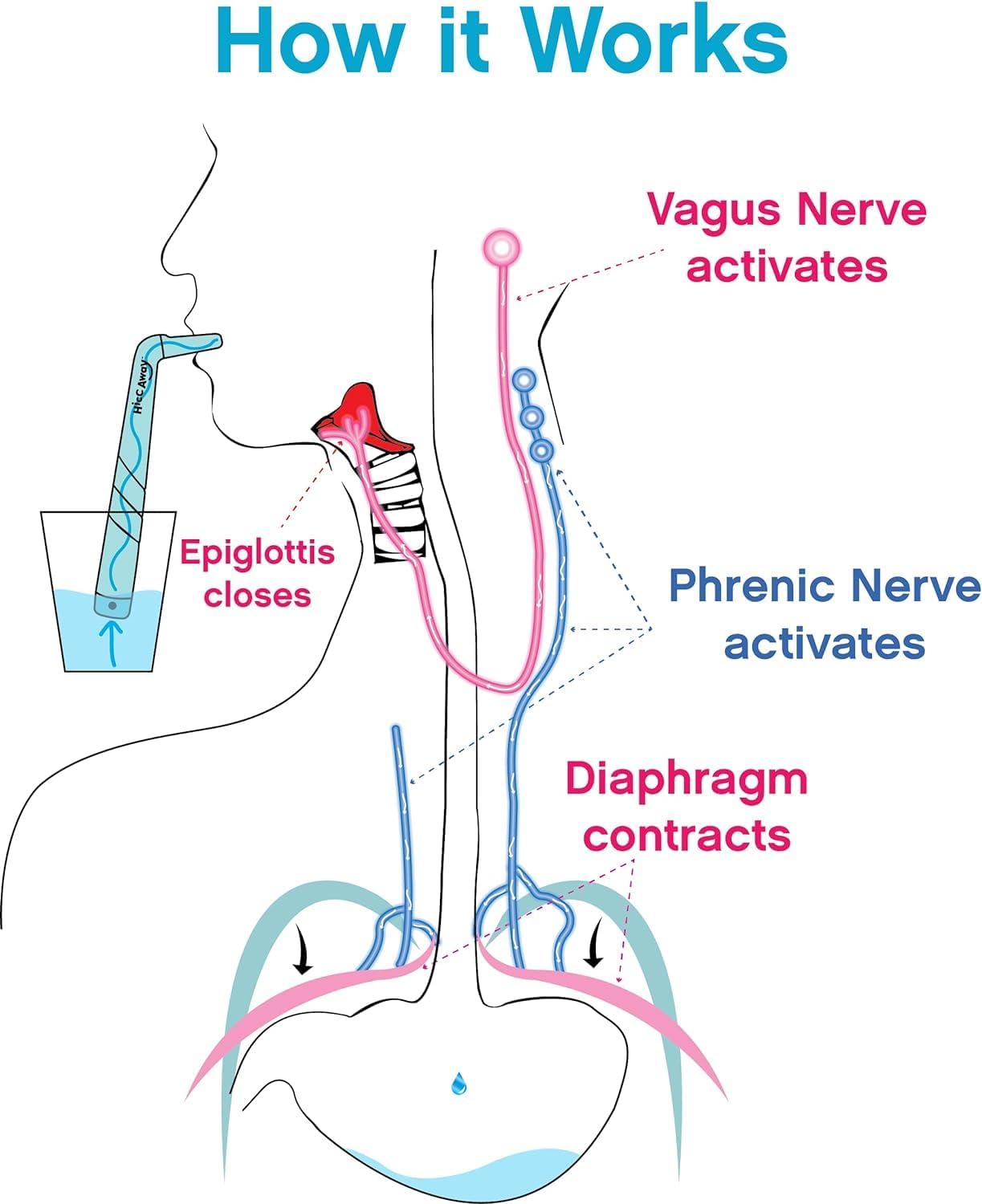 🔥Hot Sale 🔥Hiccup Straw - Stops Hiccups Naturally
