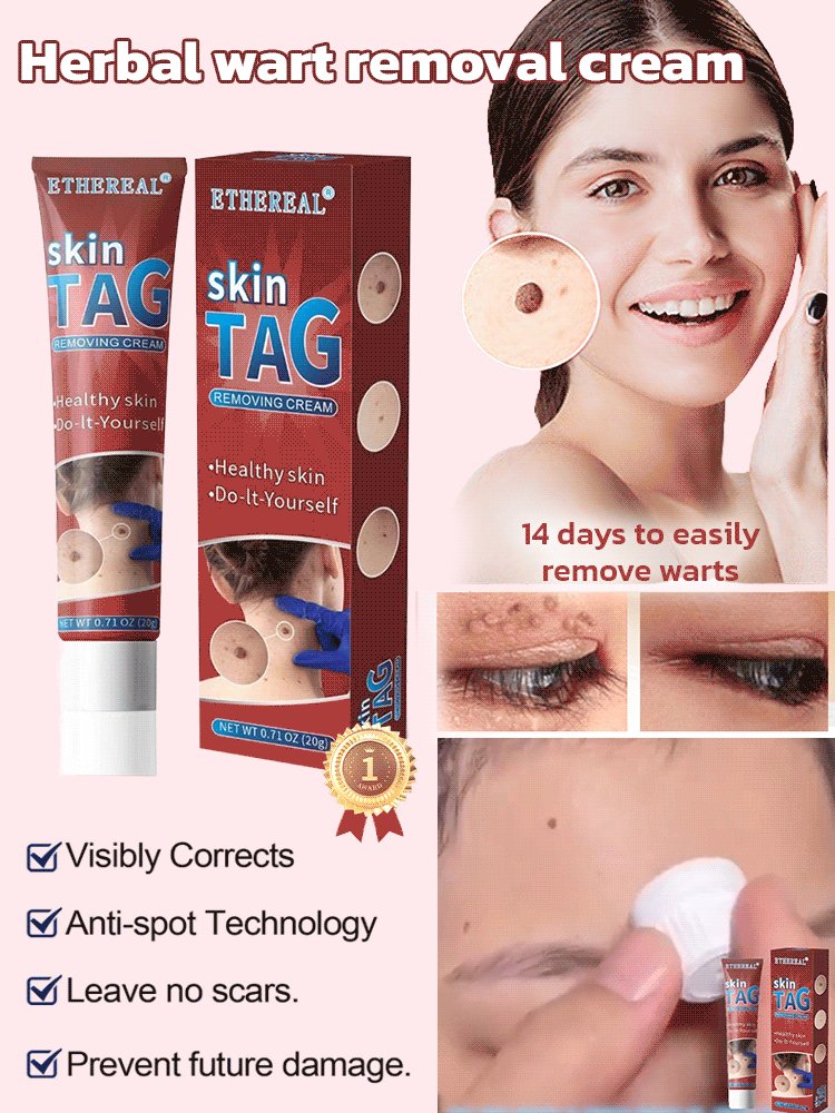 🔥Hot Sale 🔥 Herbal wart and corn removal cream