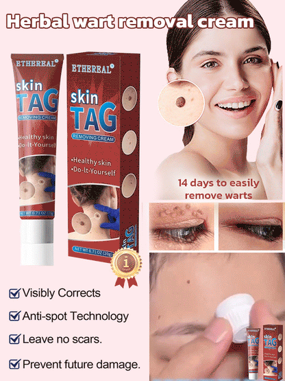 🔥Hot Sale 🔥 Herbal wart and corn removal cream