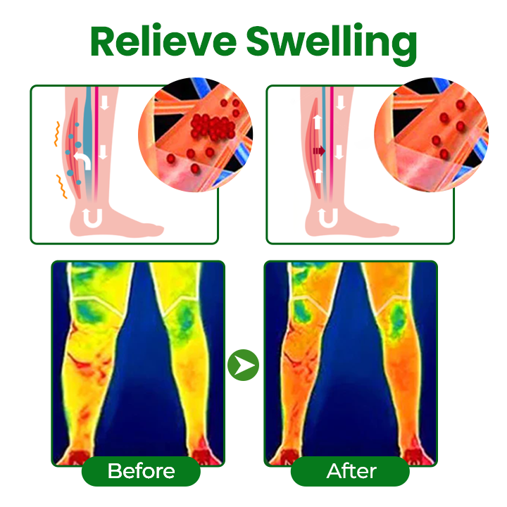 🔥Hot Sale 🔥LAOZIKTM VenoSoothe Leg Relief Spray