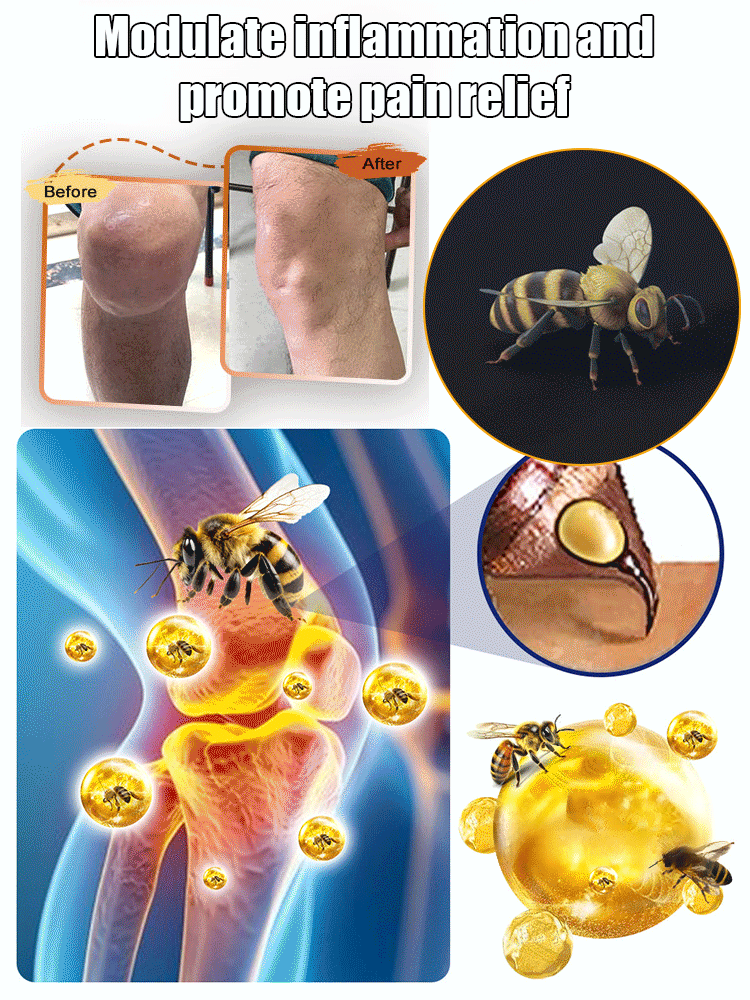 🔥Hot Sale 🔥 Bee Venom Joint Repair Cream