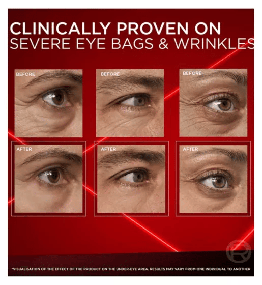 🔥Limited Time Discount 🔥 NEW Revitalift Laser Eye Bag Eraser – Instant Gel-to-Tape Formula for Puffy Eyes & Wrinkles (Up to 8H)