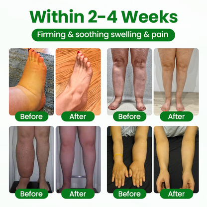 🔥Hot Sale 🔥LAOZIKTM VenoSoothe Leg Relief Spray