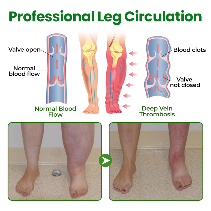 🔥Hot Sale 🔥LAOZIKTM VenoSoothe Leg Relief Spray