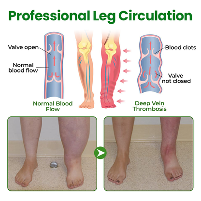 🔥Hot Sale 🔥LAOZIKTM VenoSoothe Leg Relief Spray