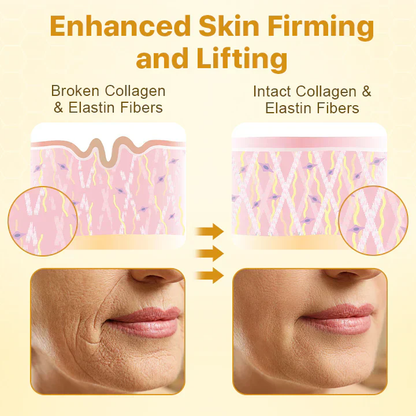 🔥Limited Time Discount 🔥 Botox Bee Venom Wrinkle Removal Lifting Cream